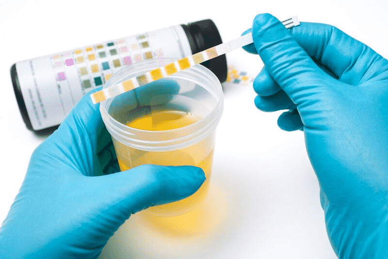 weedsmart_image_weed urine test